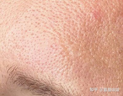 图片[5]-收缩毛孔效果好的产品有哪些？-一鸣资源网