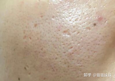 图片[3]-收缩毛孔效果好的产品有哪些？-一鸣资源网