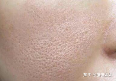 图片[4]-收缩毛孔效果好的产品有哪些？-一鸣资源网