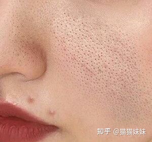 图片[1]-收缩毛孔效果好的产品有哪些？-一鸣资源网