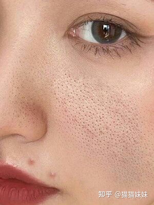 图片[2]-收缩毛孔效果好的产品有哪些？-一鸣资源网