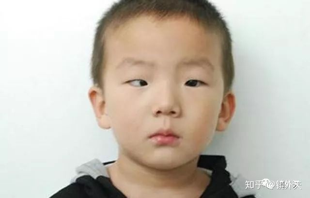 图片[7]-近视不可怕，可怕的是高度近视以后出现的并发症？-一鸣资源网