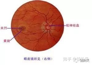 图片[9]-近视不可怕，可怕的是高度近视以后出现的并发症？-一鸣资源网